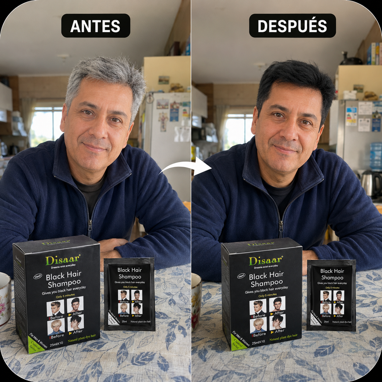 Shampoo Anticanas™  5 Minutos
