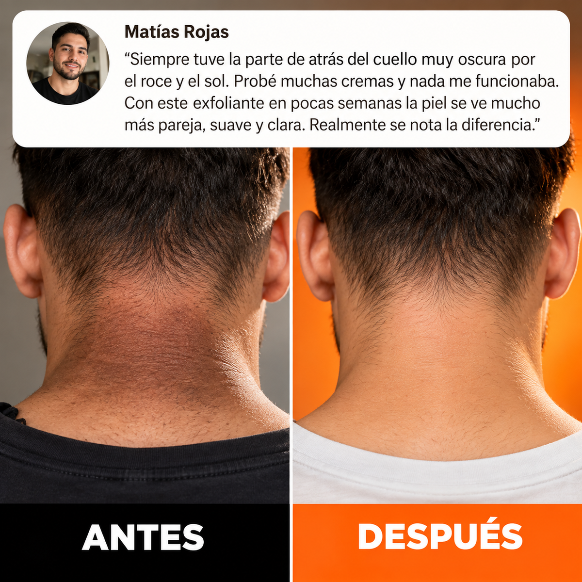 Dr. Melaxin Peel Shot · Spray Exfoliante para Codos, Rodillas y Axilas